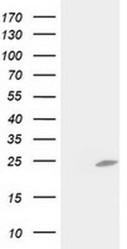 Invitrogen C1orf50 Monoclonal Antibody (OTI1F9) 100 &mu;L | Buy Online | Invitrogen&trade; | Fisher Scientific