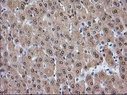 Invitrogen Alcohol Dehydrogenase 1B Monoclonal Antibody (OTI3F2) 100 &mu;L;