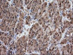 Invitrogen Alcohol Dehydrogenase 1B Monoclonal Antibody (OTI3F2) 100 &mu;L;