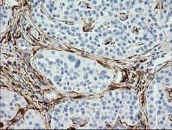 Invitrogen Alcohol Dehydrogenase 1B Monoclonal Antibody (OTI3F2) 100 &mu;L;