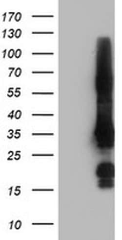 Invitrogen GRAP2 Monoclonal Antibody (OTI1G2) 100 &mu;L; Unconjugated:Antibodies,
