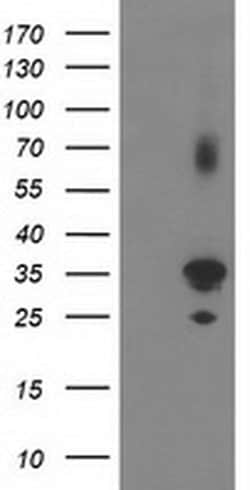 Invitrogen PLEKHA3 Monoclonal Antibody (OTI5D11) 100 &mu;L; Unconjugated:Antibodies,