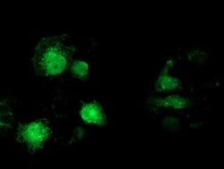 Invitrogen MAPRE2 Monoclonal Antibody (OTI7A2) 100 &mu;L; Unconjugated:Antibodies,