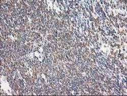 Invitrogen MAPRE2 Monoclonal Antibody (OTI7A2) 100 &mu;L; Unconjugated:Antibodies,