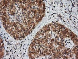 Invitrogen MAPRE2 Monoclonal Antibody (OTI7A2) 100 &mu;L; Unconjugated:Antibodies,