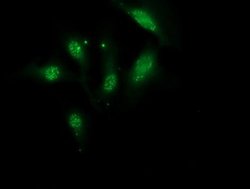 Invitrogen Monoacylglycerol Lipase Monoclonal Antibody (OTI1H1) 100 &mu;L;