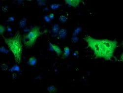 Invitrogen Monoacylglycerol Lipase Monoclonal Antibody (OTI1H1) 100 &mu;L;