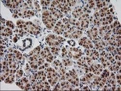 Invitrogen Monoacylglycerol Lipase Monoclonal Antibody (OTI1H1) 100 &mu;L;