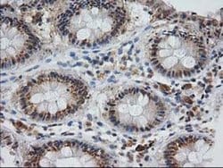 Invitrogen Monoacylglycerol Lipase Monoclonal Antibody (OTI1H1) 100 &mu;L;
