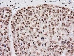 Invitrogen Monoacylglycerol Lipase Monoclonal Antibody (OTI1H1) 100 &mu;L;