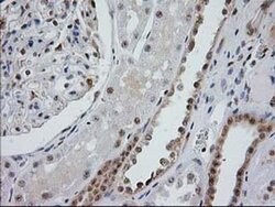 Invitrogen Monoacylglycerol Lipase Monoclonal Antibody (OTI1H1) 100 &mu;L;