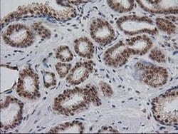 Invitrogen Monoacylglycerol Lipase Monoclonal Antibody (OTI1H1) 100 &mu;L;