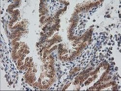 Invitrogen Monoacylglycerol Lipase Monoclonal Antibody (OTI1H1) 100 &mu;L;