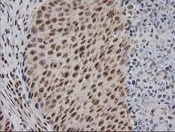 Invitrogen Monoacylglycerol Lipase Monoclonal Antibody (OTI1H1) 100 &mu;L;
