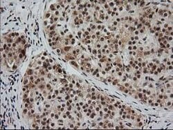 Invitrogen Monoacylglycerol Lipase Monoclonal Antibody (OTI1H1) 100 &mu;L;