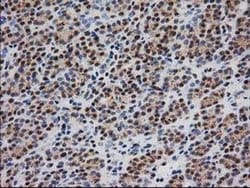 Invitrogen Monoacylglycerol Lipase Monoclonal Antibody (OTI1H1) 100 &mu;L;