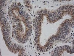 Invitrogen Monoacylglycerol Lipase Monoclonal Antibody (OTI1H1) 100 &mu;L;