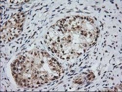 Invitrogen Monoacylglycerol Lipase Monoclonal Antibody (OTI1H1) 100 &mu;L;
