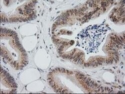 Invitrogen Monoacylglycerol Lipase Monoclonal Antibody (OTI1H1) 100 &mu;L;