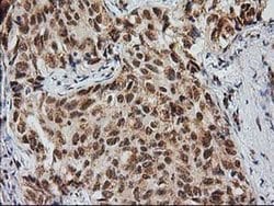 Invitrogen Monoacylglycerol Lipase Monoclonal Antibody (OTI1H1) 100 &mu;L;