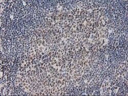 Invitrogen Monoacylglycerol Lipase Monoclonal Antibody (OTI1H1) 100 &mu;L;