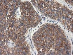 Invitrogen beta-4 Tubulin Monoclonal Antibody (OTI3C12) 100 &mu;L; Unconjugated:Antibodies,