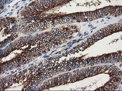 Invitrogen beta-4 Tubulin Monoclonal Antibody (OTI3C12) 100 &mu;L; Unconjugated:Antibodies,