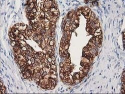 Invitrogen beta-4 Tubulin Monoclonal Antibody (OTI3C12) 100 &mu;L; Unconjugated:Antibodies,