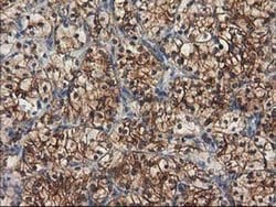 Invitrogen beta-4 Tubulin Monoclonal Antibody (OTI3C12) 100 &mu;L; Unconjugated:Antibodies,