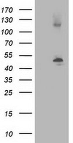 Invitrogen beta-4 Tubulin Monoclonal Antibody (OTI3C12) 100 &mu;L; Unconjugated:Antibodies,