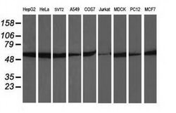 Invitrogen beta-4 Tubulin Monoclonal Antibody (OTI3C12) 100 &mu;L; Unconjugated:Antibodies,