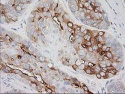 Invitrogen BAIAP2 Monoclonal Antibody (OTI 1D9) 100 &mu;L; Unconjugated:Antibodies,