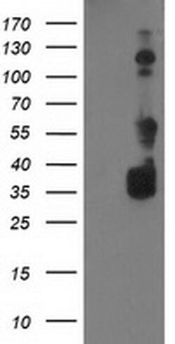 Invitrogen BAIAP2 Monoclonal Antibody (OTI 1D9) 100 &mu;L; Unconjugated:Antibodies,