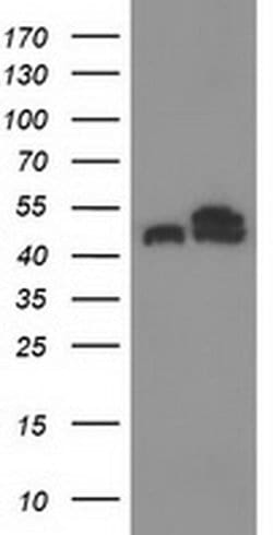 Invitrogen beta-4 Tubulin Monoclonal Antibody (OTI3F1) 100 &mu;L | Buy Online | Invitrogen&trade; | Fisher Scientific