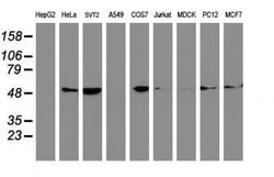 Invitrogen beta-4 Tubulin Monoclonal Antibody (OTI3F1) 100 &mu;L | Buy Online | Invitrogen&trade; | Fisher Scientific