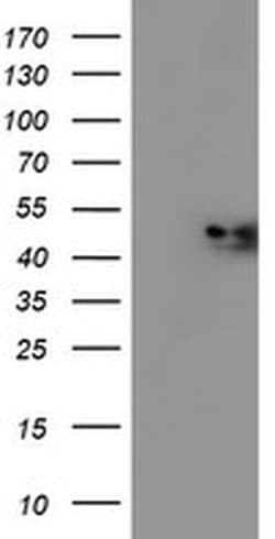 Invitrogen NDUFAF7 Monoclonal Antibody (OTI4A5) 100 &mu;L; Unconjugated:Antibodies,