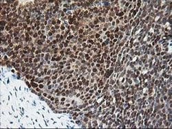 Invitrogen PDXK Monoclonal Antibody (OTI5H5) 100 &mu;L; Unconjugated:Antibodies,
