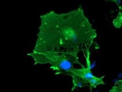 LIMK1 Monoclonal Antibody (OTI6B4):Antibodies, Monoclonal