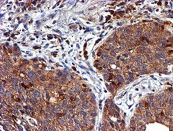 LIMK1 Monoclonal Antibody (OTI6B4):Antibodies, Monoclonal