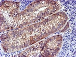 LIMK1 Monoclonal Antibody (OTI6B4):Antibodies, Monoclonal