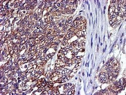 LIMK1 Monoclonal Antibody (OTI6B4):Antibodies, Monoclonal