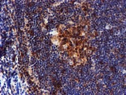 LIMK1 Monoclonal Antibody (OTI6B4):Antibodies, Monoclonal