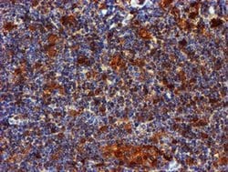 LIMK1 Monoclonal Antibody (OTI6B4):Antibodies, Monoclonal