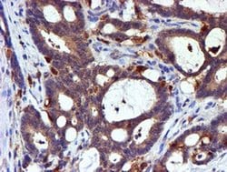 LIMK1 Monoclonal Antibody (OTI6B4):Antibodies, Monoclonal