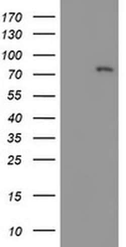 LIMK1 Monoclonal Antibody (OTI6B4):Antibodies, Monoclonal