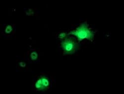 Invitrogen AP2M1 Monoclonal Antibody (OTI1F10) 100 &mu;L; Unconjugated:Antibodies,