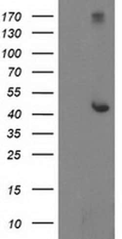 Invitrogen AP2M1 Monoclonal Antibody (OTI1F10) 100 &mu;L; Unconjugated:Antibodies,
