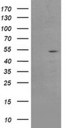 Invitrogen AP2M1 Monoclonal Antibody (OTI1B11) 100 &mu;L; Unconjugated:Antibodies,