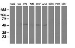 Invitrogen AP2M1 Monoclonal Antibody (OTI1B11) 100 &mu;L; Unconjugated:Antibodies,