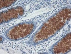 Invitrogen AP2M1 Monoclonal Antibody (OTI 2F11) 100 &mu;L; Unconjugated:Antibodies,